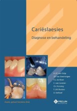 Samenvatting: Carieslaesies Diagnose En Behandeling | 9789085621300 | Augustinus Johannes Paulus Strijp, et al Afbeelding van boekomslag