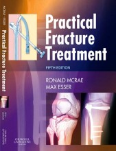 Samenvatting: Practical Fracture Treatment | 9781455725236 | Ronald McRae, et al Afbeelding van boekomslag