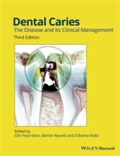 Summary: Dental Caries The Disease And Its Clinical Management | 9781118935828 | Ole Fejerskov, et al Book cover image